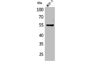 Western Blot analysis of MCF7 cells using CD85g Polyclonal Antibody (LILRA4 antibody  (Internal Region))