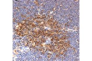 Immunohistochemical staining in mouse thymus with PFN1 polyclonal antibody . (PFN1 antibody  (AA 100-140))