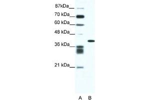 WB Suggested Anti-ALX4 Antibody Titration: 0. (ALX4 antibody  (N-Term))