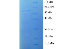 SDS-PAGE (SDS) image for Stratifin (SFN) (AA 1-248), (full length) protein (GST tag) (ABIN5710354) (14-3-3 sigma/SFN Protein (AA 1-248, full length) (GST tag))