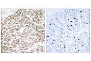 Immunohistochemistry (IHC) image for anti-Ras-Related Associated with Diabetes (RRAD) (Internal Region) antibody (ABIN1851412) (RRAD antibody  (Internal Region))