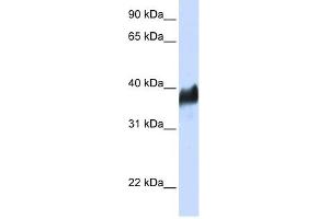 CLN8 antibody used at 1 ug/ml to detect target protein.