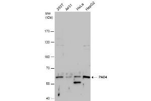 WB Image PAD4 antibody detects PAD4 protein by western blot analysis. (PAD4 antibody  (Center))