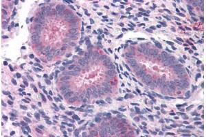 Human Uterus: Formalin-Fixed, Paraffin-Embedded (FFPE) (ELP3/KAT9 antibody  (AA 240-445))