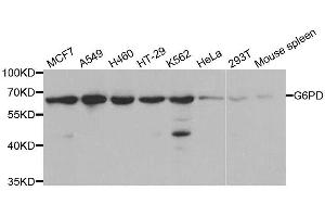 Western blot analysis of extracts of various cell lines, using G6PD antibody. (Glucose-6-Phosphate Dehydrogenase antibody  (AA 246-545))