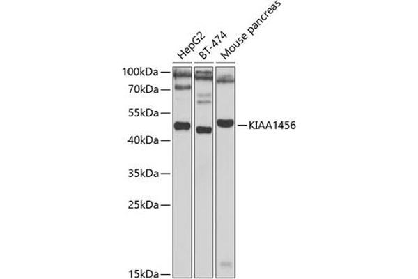 KIAA1456 antibody  (AA 110-330)