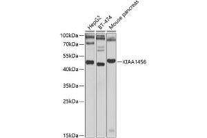 Western blot analysis of extracts of various cell lines, using KI antibody (ABIN6132140, ABIN6142847, ABIN6142849 and ABIN6223016) at 1:1000 dilution.