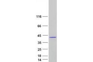 Validation with Western Blot (TBX20 Protein (Transcript Variant 2) (Myc-DYKDDDDK Tag))