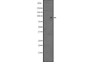 Western Blotting (WB) image for anti-BTB and CNC Homology 1, Basic Leucine Zipper Transcription Factor 2 (BACH2) (Internal Region) antibody (ABIN6257741)