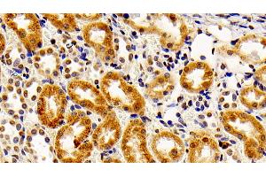 Detection of FGF2 in Rabbit Kidney Tissue using Polyclonal Antibody to Fibroblast Growth Factor 2, Basic (FGF2)