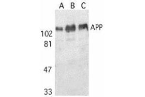 Western blot analysis of APP in human (A), mouse (B), and rat (C) brain tissue lysates with AP30070PU-N APP antibody at 1 μg/ml.