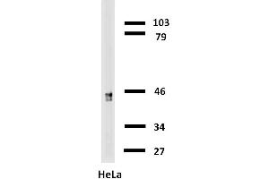 Western blotting analysis of cytokeratin 18 in HeLa cells with anti-cytokeratin 18 biotin. (Cytokeratin 18 antibody  (Biotin))