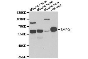 Western blot analysis of extracts of various cell lines, using SMPD1 antibody. (SMPD1 antibody  (AA 70-340))