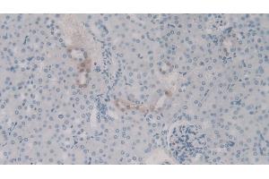 Detection of C4a in Mouse Kidney Tissue using Polyclonal Antibody to Complement Component 4a (C4a) (C4A antibody)