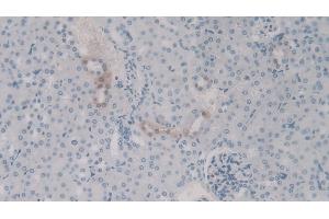Detection of C4a in Mouse Kidney Tissue using Polyclonal Antibody to Complement Component 4a (C4a) (C4A antibody)