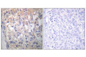 Immunohistochemistry (IHC) image for anti-FYN Oncogene Related To SRC, FGR, YES (FYN) (pTyr530) antibody (ABIN1847258)