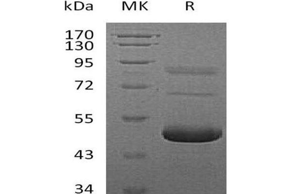 Ephrin A5 Protein (EFNA5) (His tag)