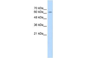 WB Suggested Anti-SARDH Antibody Titration: 2. (SARDH antibody  (Middle Region))