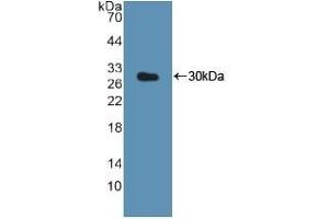 Detection of Recombinant CTSK, Human using Polyclonal Antibody to Cathepsin K (CTSK) (Cathepsin K antibody  (AA 54-317))