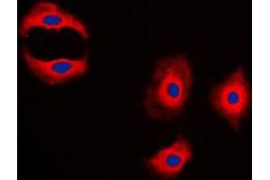 Immunofluorescent analysis of MMP3 staining in A431 cells. (MMP3 antibody  (C-Term))