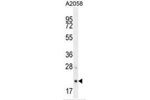 AP3S1 Antibody (N-term) western blot analysis in A2058 cell line lysates (35µg/lane). (AP3S1 antibody  (N-Term))