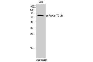 Western Blotting (WB) image for anti-P21-Activated Kinase 1 (PAK1) (pThr212) antibody (ABIN3182552) (PAK1 antibody  (pThr212))