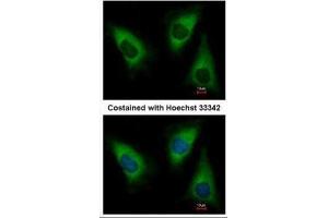 ICC/IF Image Immunofluorescence analysis of paraformaldehyde-fixed HeLa, using Lysyl-tRNA synthetase, antibody at 1:500 dilution. (KARS antibody)