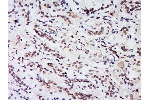 Formalin-fixed and paraffin embedded human kidney labeled with Rabbit Anti-HS1BP3 Polyclonal Antibody, Unconjugated  at 1:200 followed by conjugation to the secondary antibody and DAB staining. (HS1BP3 antibody  (AA 51-130))