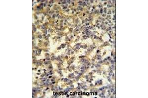 G6PD Antibody (Center) (ABIN651286 and ABIN2840171) IHC analysis in formalin fixed and paraffin embedded testis followed by peroxidase conjugation of the secondary antibody and DAB staining. (Glucose-6-Phosphate Dehydrogenase antibody  (AA 297-326))