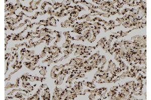 ABIN6264086 and ABIN6279212 at 1/100 staining Human lung tissue by IHC-P.