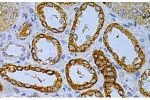 Immunohistochemistry of paraffin-embedded Human kidney using OLR1 Polyclonal Antibody at dilution of 1:200 (40x lens). (OLR1 antibody)