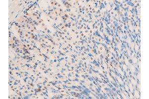 ABIN6267283 at 1/100 staining mouse gastric tissue sections by IHC-P. (ErbB2/Her2 antibody  (pTyr1248))