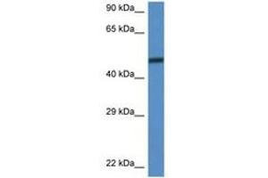 Image no. 1 for anti-SWI/SNF Related, Matrix Associated, Actin Dependent Regulator of Chromatin, Subfamily D, Member 3 (SMARCD3) (C-Term) antibody (ABIN6747287)