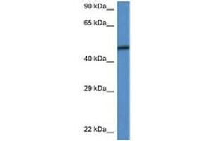 Image no. 1 for anti-SWI/SNF Related, Matrix Associated, Actin Dependent Regulator of Chromatin, Subfamily D, Member 3 (SMARCD3) (C-Term) antibody (ABIN6747287) (SMARCD3 antibody  (C-Term))