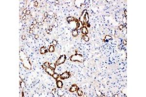Anti-Glucose Transporter 5 GLUT5 antibody, IHC(P) IHC(P): Rat Kidney Tissue (SLC2A5 antibody  (Middle Region))