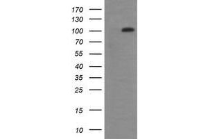 Image no. 6 for anti-DEAD (Asp-Glu-Ala-Asp) Box Polypeptide 58 (DDX58) antibody (ABIN1500708) (DDX58 antibody)