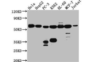 Western Blot Positive WB detected in: Hela whole cell lysate, HepG2 whole cell lysate, PC-3 whole cell lysate, K562 whole cell lysate, HL-60 whole cell lysate, MCF-7 whole cell lysate, Jurkat whole cell lysate All lanes: PTBP1 antibody at 1:1000 Secondary Goat polyclonal to rabbit IgG at 1/50000 dilution Predicted band size: 58, 60, 60 kDa Observed band size: 58 kDa (Recombinant PTBP1 antibody)