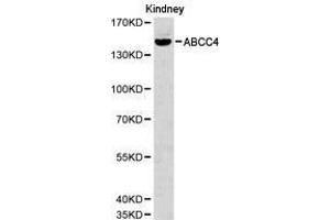 Western Blotting (WB) image for anti-ATP-Binding Cassette, Sub-Family C (CFTR/MRP), Member 4 (ABCC4) antibody (ABIN1870721) (ABCC4 antibody)