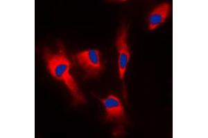 Immunofluorescent analysis of Calmodulin staining in MCF7 cells. (Calmodulin 1 antibody  (Center))