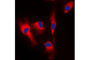 Immunofluorescent analysis of Calmodulin staining in MCF7 cells.