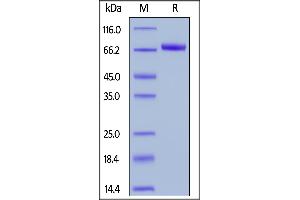 Biotinylated Human Dkk-1, Fc,Avitag on  under reducing (R) condition. (DKK1 Protein (AA 32-266) (Fc Tag,AVI tag,Biotin))