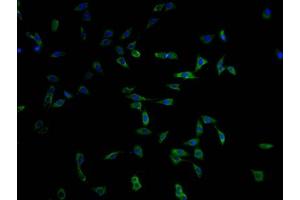 Myosin XV (MYO15) (AA 237-451) antibody