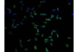 Immunofluorescence staining of MCF-7 cells with ABIN7174974 at 1:100, counter-stained with DAPI. (Myosin XV (MYO15) (AA 237-451) antibody)