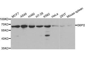 Western blot analysis of extracts of various cell lines, using G6PD antibody. (Glucose-6-Phosphate Dehydrogenase antibody)