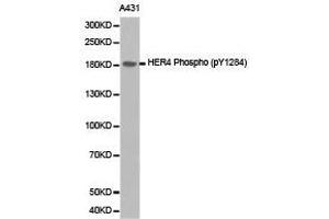 Western Blotting (WB) image for anti-V-Erb-A erythroblastic Leukemia Viral Oncogene Homolog 4 (Avian) (ERBB4) (pTyr1284) antibody (ABIN1870170) (ERBB4 antibody  (pTyr1284))