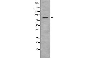 RPS6KA6 antibody  (C-Term)