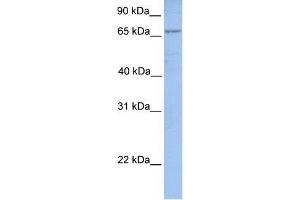 Human MCF-7; WB Suggested Anti-ACSL1 Antibody Titration: 0. (ACSL1 antibody  (N-Term))