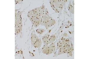 Immunohistochemistry (Paraffin-embedded Sections) (IHC (p)) image for anti-X-Ray Repair Complementing Defective Repair in Chinese Hamster Cells 6 (XRCC6) (AA 500-600) antibody (ABIN1513143)