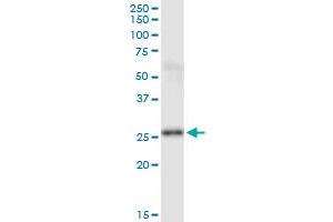 PSPH monoclonal antibody (M01), clone 3A5. (PSPH antibody  (AA 1-225))