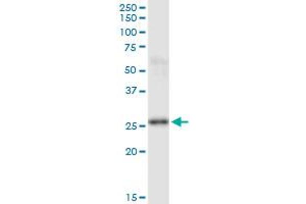 PSPH antibody  (AA 1-225)